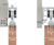 Trakkit Quiesce wardrobe sliding door gear kit 9