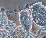 ANITA™ Mox - MBBR sidestream ammonia treatment