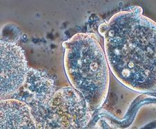 ANITA™ Mox - MBBR sidestream ammonia treatment