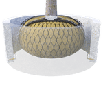 Eyebolt System - Plati-Mat for concrete ring/base 