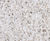 Kellen Breccia - washed concrete paving with CERO 3