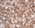 Limestone Decorative Aggregates - crushed sub-base for driveways & highways 1
