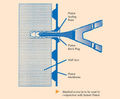 Membrane screw ties
